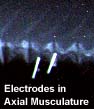axial musculature electrodes