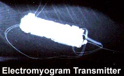 electromyogram transmitter
